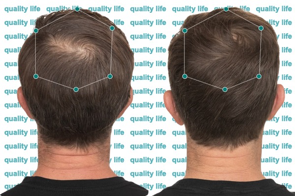 Gerçek Kullanıcı Memnuniyeti