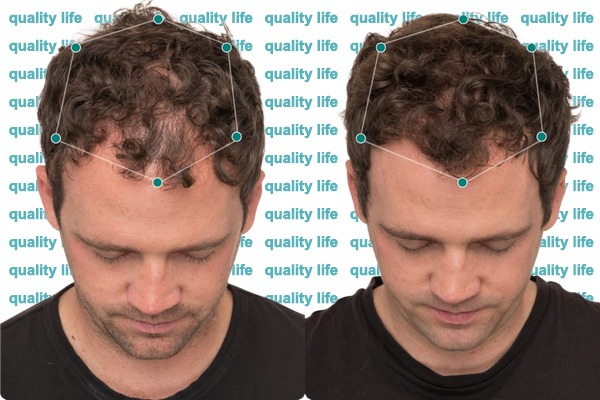 Bugüne Özel Mega Avantaj